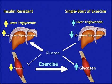 Reversal of muscle insulin resistance with exercise reduces postprandial hepatic de novo ...