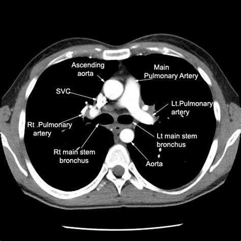 Pin by Lauren on Radiology | Medical radiography, Radiology, Radiology imaging