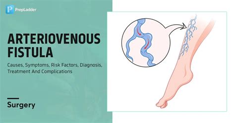 Arteriovenous Fistula : Causes, Symptoms, Risk Factors, Diagnosis, Treatment and Complications