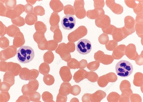 Blood smear, light microscopy - Stock Image - C022/5091 - Science Photo Library