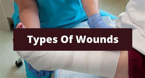 Types Of Wounds