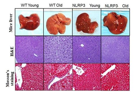 Representative liver sections. Upper: Liver mice; middle: H& lower:... | Download Scientific Diagram