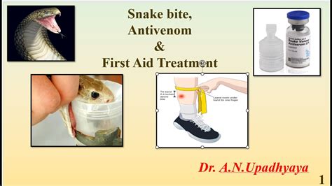 Snake bite, Antivenom & First Aid Treatment - YouTube