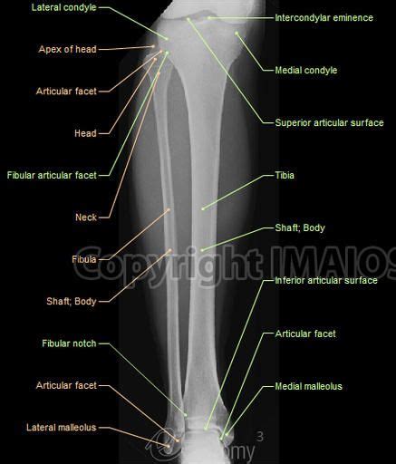 anatomy musculoskeletal x ray - Google Search | Medical radiography, Radiology technician ...