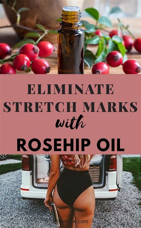 5 Best Rosehip Oils for Stretch Marks | Oil for stretch marks, Stretch marks, Rosehip oil