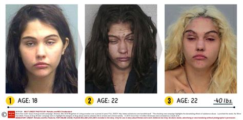 Before and after pics of crystal meth users are enough to put you off for life | Metro News