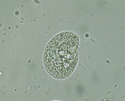 Protist Images: Ciliophora: unidentified