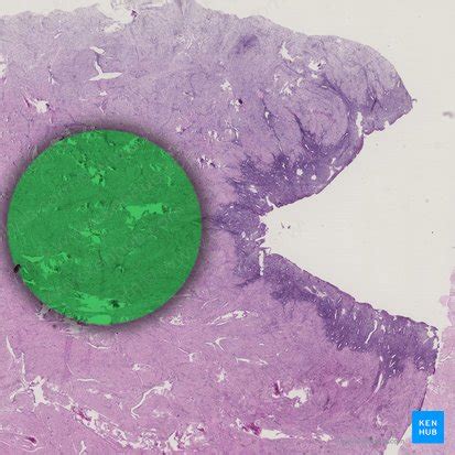 Myometrium: Histology and anatomy | Kenhub