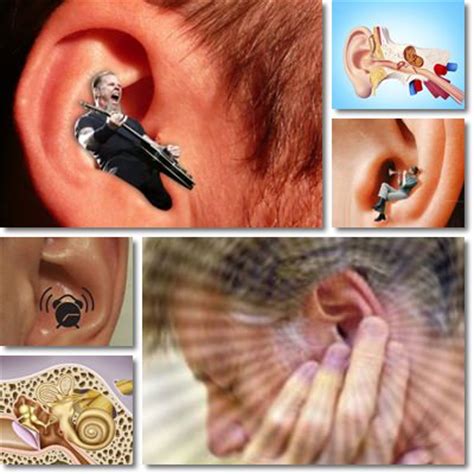 Tinnitus or Ringing Ears: Causes and Treatment - NatureWord