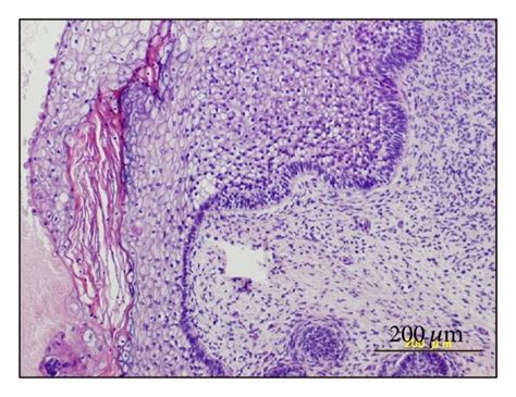 Histology of teratoma generated by Edom-iPS#S23 cells. (a) Teratoma ...