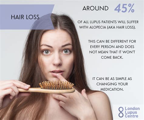 Did you know that lupus can lead to hair loss?