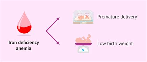 Iron deficiency anemia during pregnancy