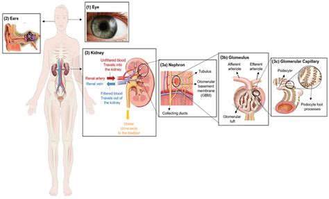 Biomedicines | Free Full-Text | A Current Landscape on Alport Syndrome Cases: Characterization ...