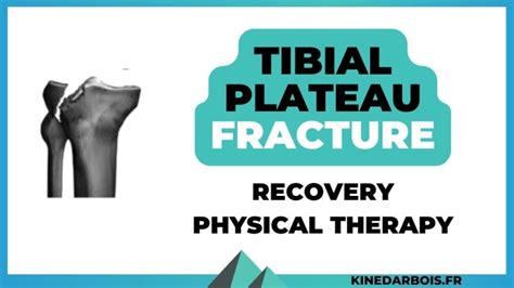 Tibial Plateau Fracture: Recovery Time & Physical Therapy Tips