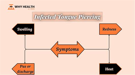 Infected Tongue Piercing: What You Need to Know