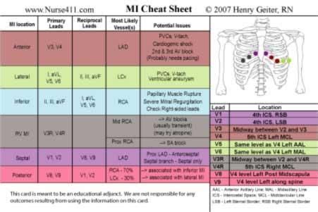 12 Lead Ekg Interpretation Cheat Sheet | Cheat Sheet