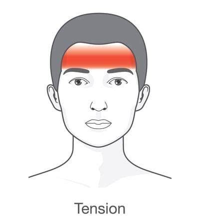 Tension Headache - Premier Neurology & Wellness Center