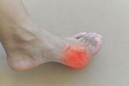 These 5 Subtle Signs of Peripheral Artery Disease (PAD) Often Show Up ...