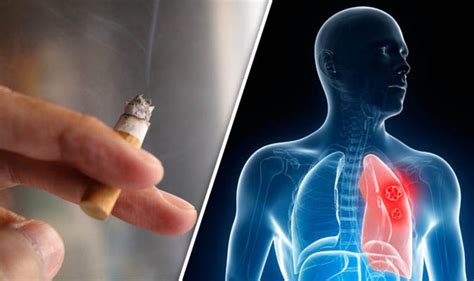 Lung cancer: ‘Light’ cigarettes make smokers more vulnerable | Express.co.uk