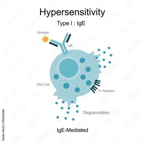 The diagram of Hypersensitivity type l : IgE (Immunoglobulin E ...