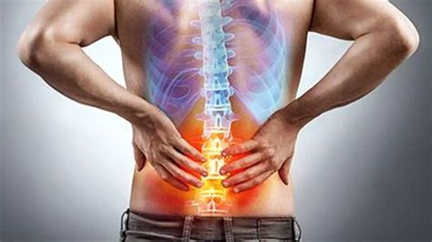 Spinal Fusion Complications Years Later - Long-term Effects of Spinal Fusion