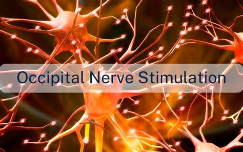 Occipital nerve stimulation - Giorgio Lambru - Neurologist