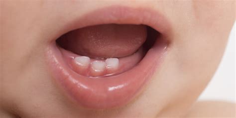 Why Are Milk Teeth Important ? - Vanilla Smiles Dental Clinic