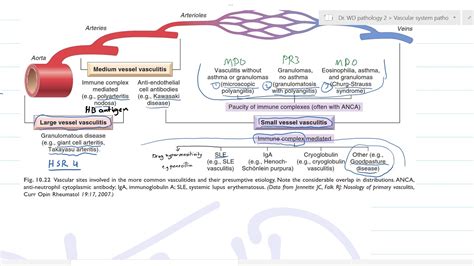 vascular pathology 7 (Dr. WD) - YouTube