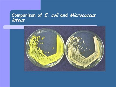 Micrococcus luteus antibiotic treatment