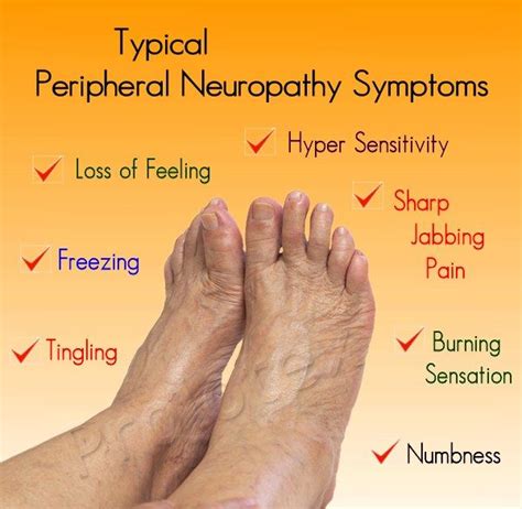 10 best Socks for Peripheral Neuropathy images on Pinterest | Peripheral neuropathy, Neuropathy ...