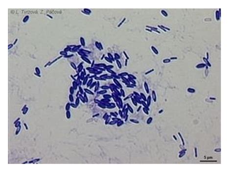 Paenibacillus polymyxa, potencial agente de control biológico contra...