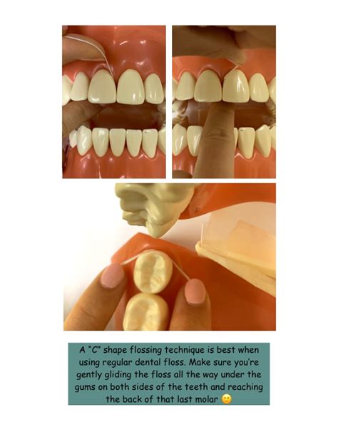 Dental Flossing Technique