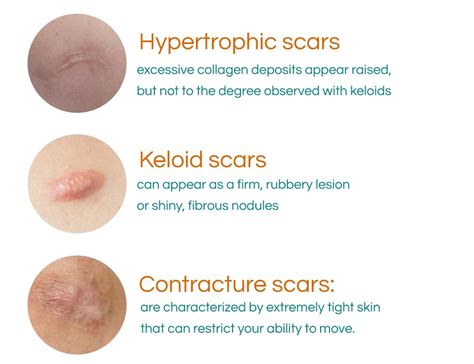 What are scars? - Oo La La Cosmetic & Laser Clinic