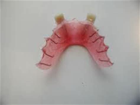 64 best images about Dental Flipper Online on Pinterest | Root canal treatment, Toothbrush ...