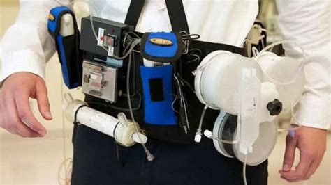 Automated wearable artificial kidney may improve peritoneal dialysis | The Better Parent