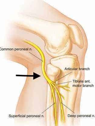 The Peroneal Nerve and Leg Pain – Howard J. Luks, MD