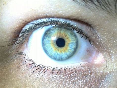 Central heterochromia Iridis Different Colored Eyes, Different Colors, Like A Cat, Green Eyes ...