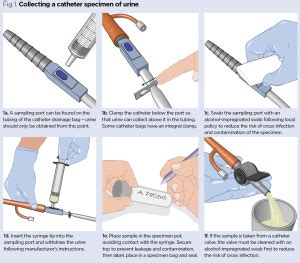 Catheter Urine Sample Collection Procedure for NMC OSCE Exam - OSCE Trainer