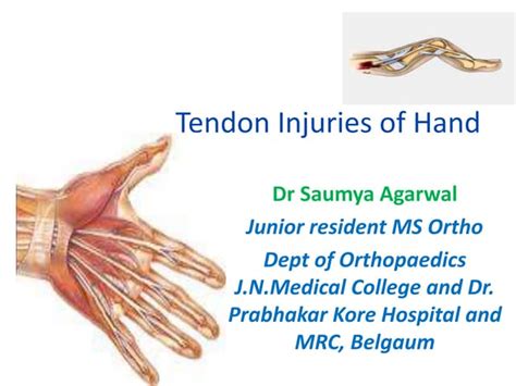 Tendon injuries of hand by Dr Saumya Agarwal | PPT