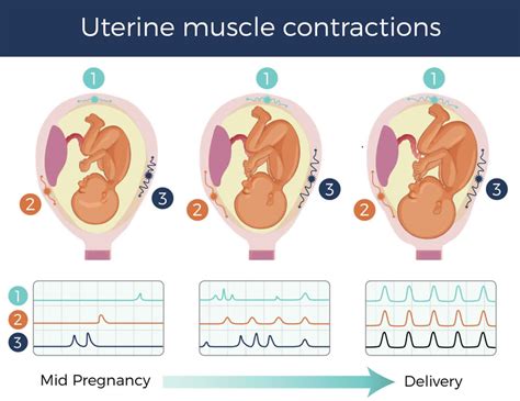 Uterine contractions causes, uterine contractions not pregnant & during labor