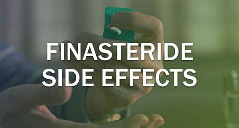 Awasome How To Minimize Finasteride Side Effects 2022 - Dotoss