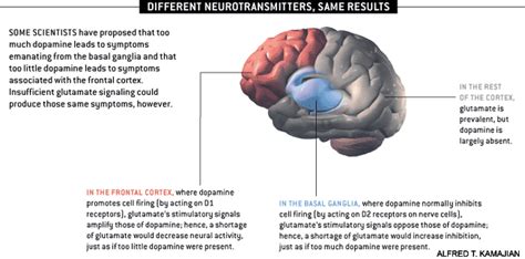 Decoding Schizophrenia | HealthyPlace