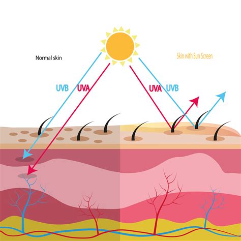 Skin Damage From Sun Exposure – South East Dermatology