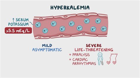 Approach to hyperkalemia: Clinical sciences - Osmosis Video Library