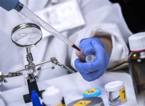 Scientific Police Extracts Crime Scene Blood in Forensic Laboratory To Verify DNA, Stock Image ...