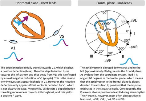 ECG interpretation: Characteristics of the normal ECG (P-wave, QRS complex, ST segment, T-wave ...