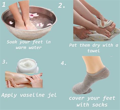 Home Remedies For Treating Dry Cracked Feet