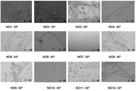 Mold hyphae microscopic observation that isolated from 12 mold that ...