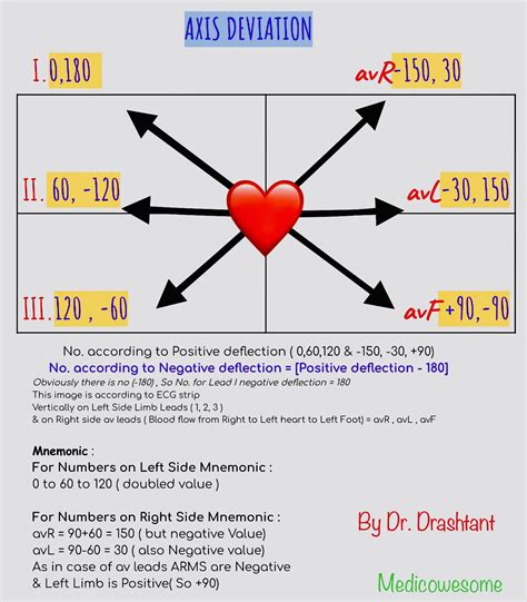 Medicowesome: All mnemonics for how to determine axis deviation of EKG