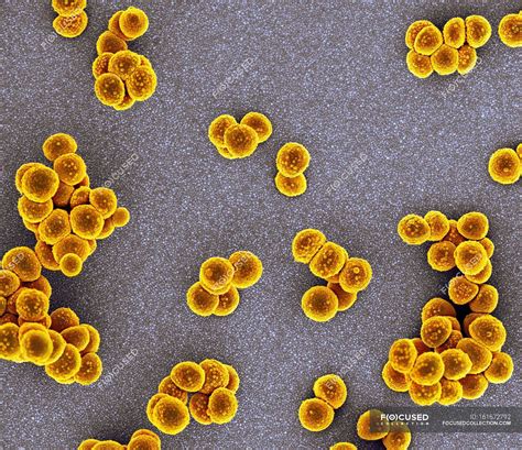 Methicillin-resistant Staphylococcus aureus — antibiotic resistant ...